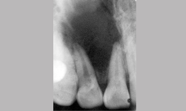 Oral surgery in Anand                        